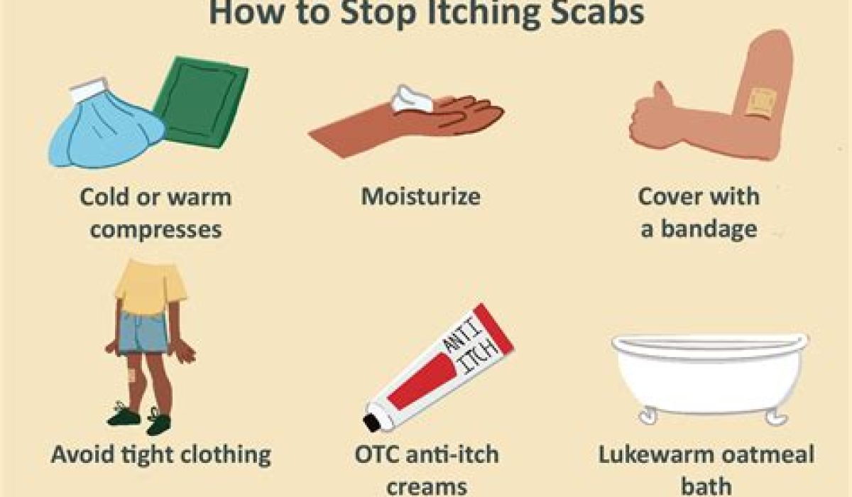 How To Stop Itching