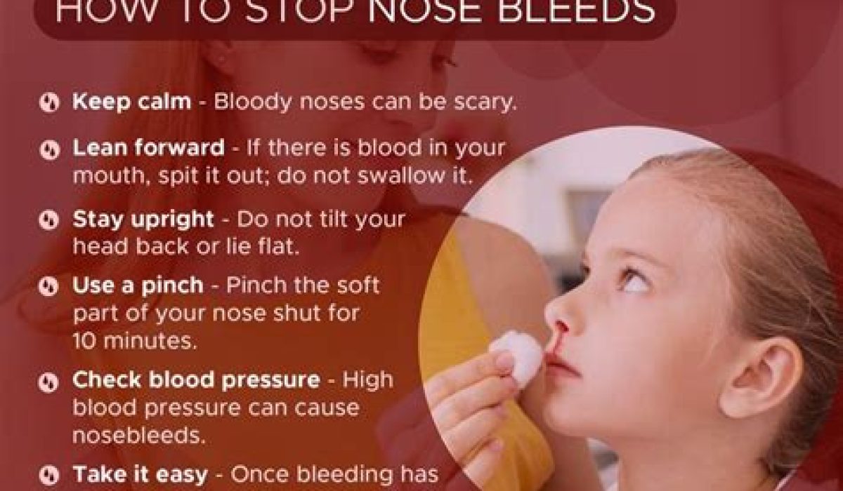 How To Stop Nosebleed