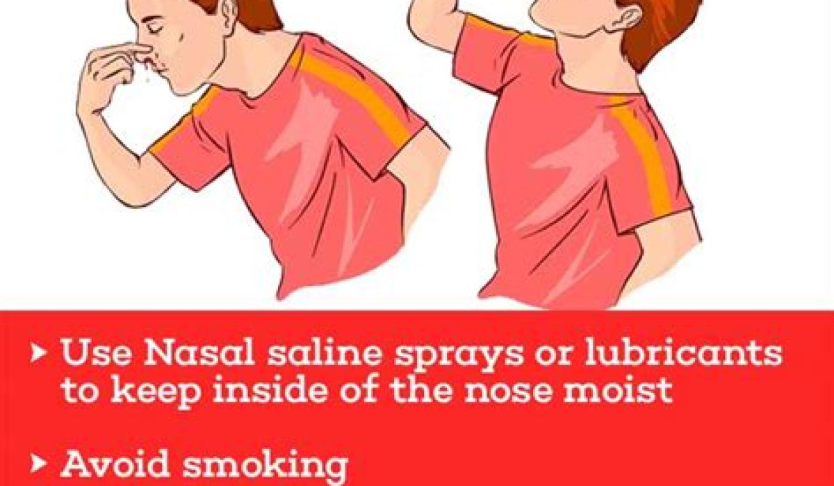 How To Stop A Nose Bleed